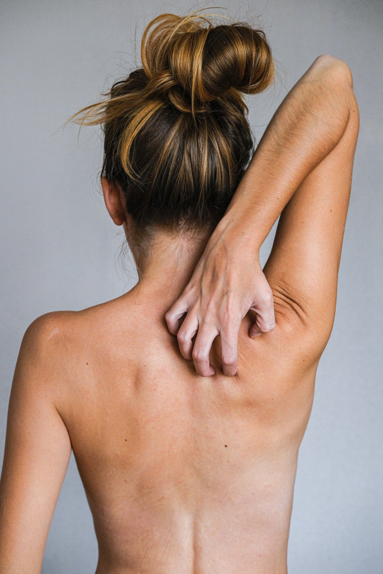 10 Tips for Dealing With Chafing Skin as a Runner