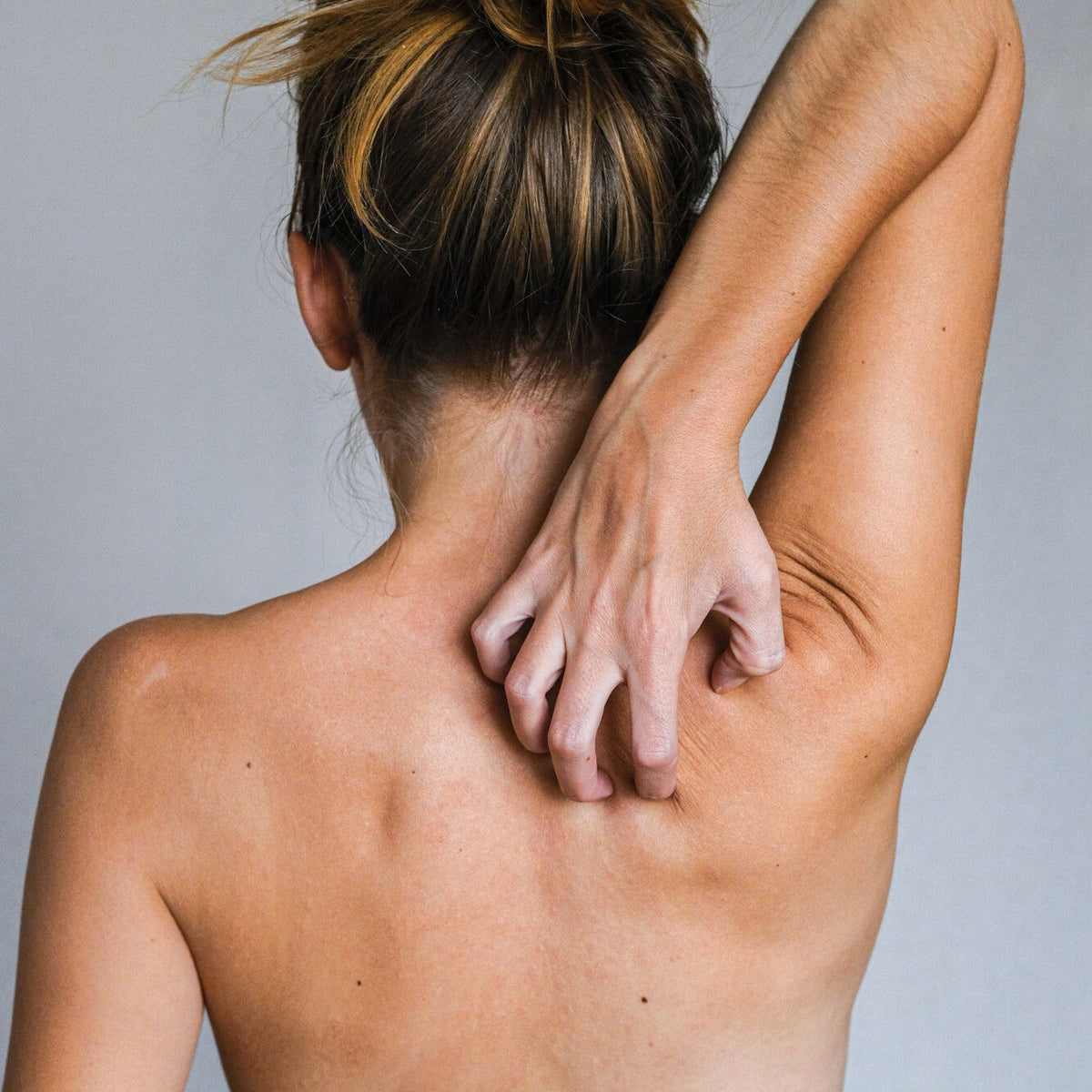 Chafing Kin 10 Tips for Dealing With Chafing Skin as a Runner | Squirrels Nut ...